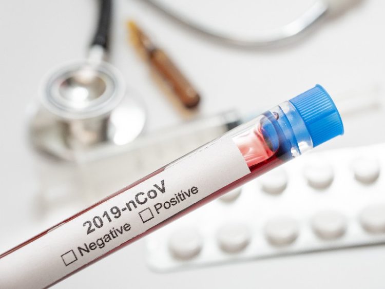 Kapal Asal India Sandar di Riau, Kapten dan ABK Positif Covid-19