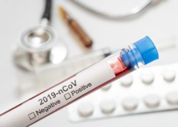 Satgas Sebut Aceh Tenggara Berstatus Zona Oranye