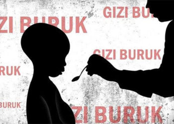 Tercatat 3.285 Anak di Aceh Besar Mengalami Stunting