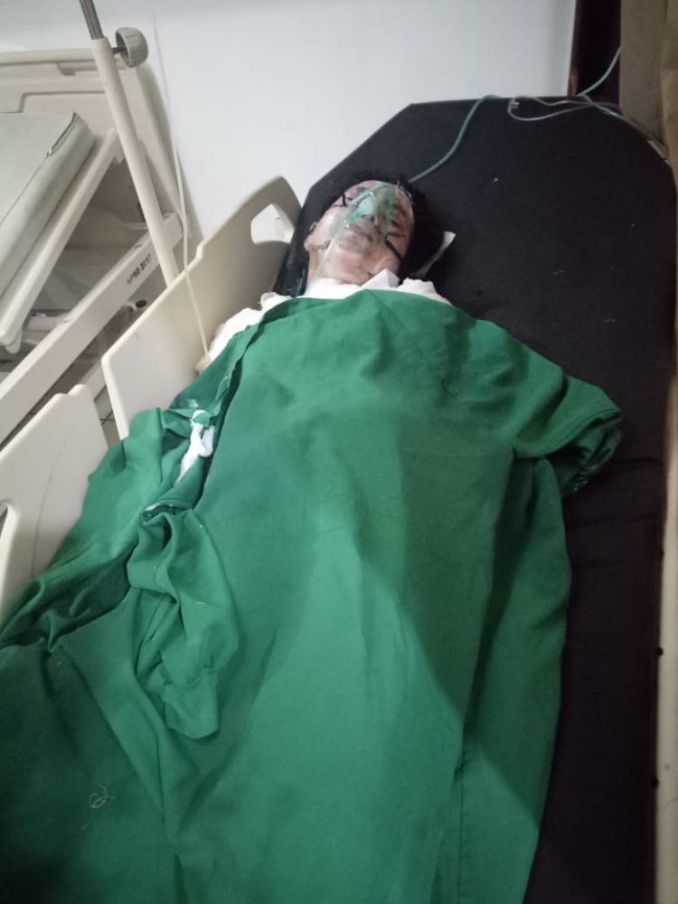 Polisi Pembakar Mantan Kekasih di Muara Enim Terancam Dipecat Tidak Hormat