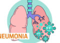 3 Orang di Argentina Meninggal Karena Pneumonia Misterius
