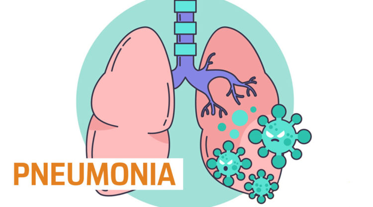 3 Orang di Argentina Meninggal Karena Pneumonia Misterius