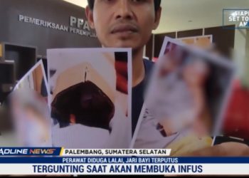 Tangan Bayi Tergunting Saat Perawatan, Ayah Bayi Lapor Polisi