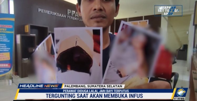Tangan Bayi Tergunting Saat Perawatan, Ayah Bayi Lapor Polisi