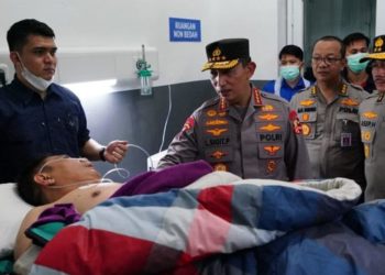 Kondisi Kapolda Jambi Membaik Pasca Operasi Dislokasi Sendi