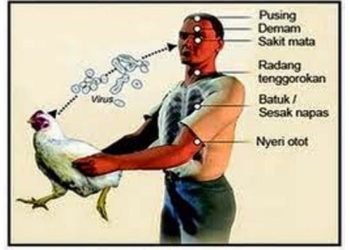 Chile Temukan Kasus Pertama Flu Vurung pada Manusia