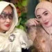 Perseteruan Hebat Doktif dan Shella Saukia Berujung Saling Lapor